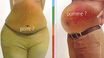 Idées reçues sur l’obésité