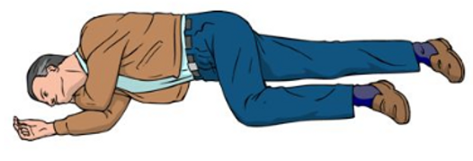 PLS : Position Latérale de Sécurité, la survie en dépend !